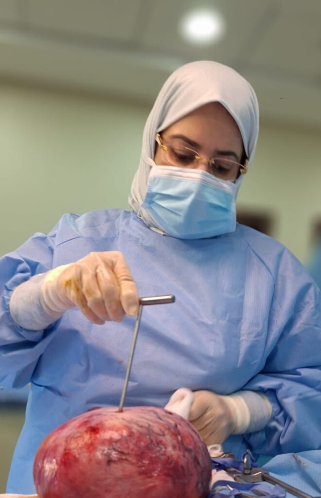 Successful Removal of Huge Uterine Fibroids Gives Renewed Hope for a Female Patient in her Early 20’s